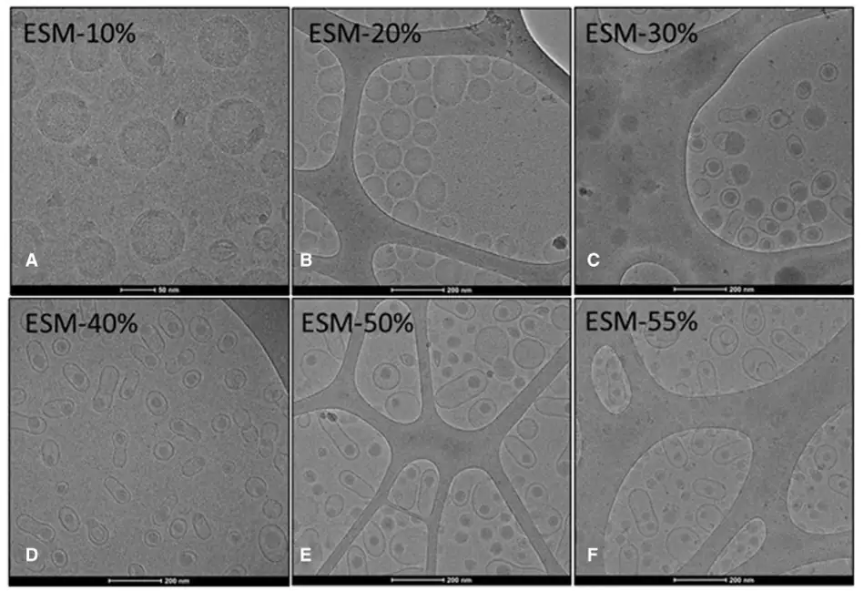 Sphyngomyelin influence on LNPs
